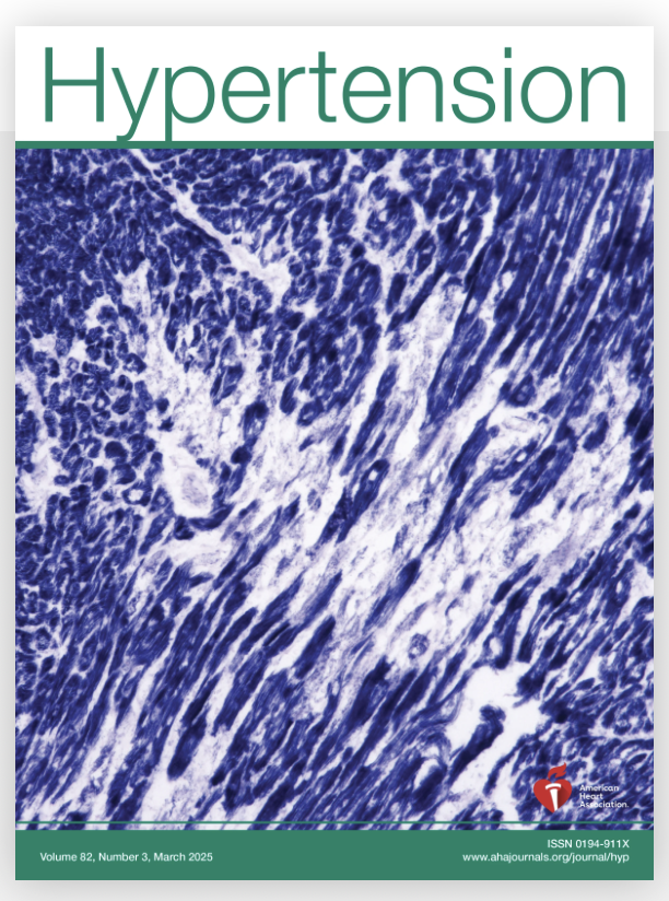 New publication on plasma S1P in ischemic stroke