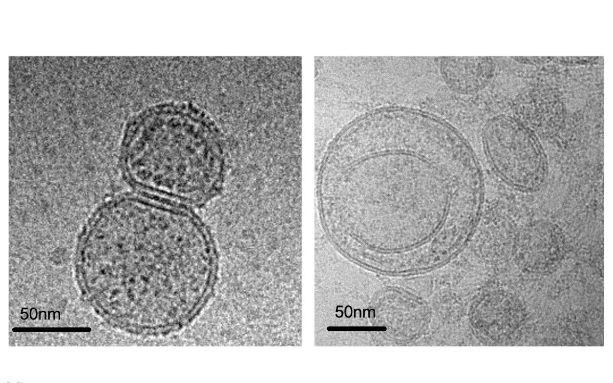 New publication on the impact of adipocyte-derived EVs on insulin secretion released