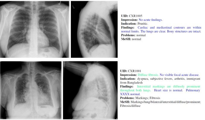 Medical Image Captioning