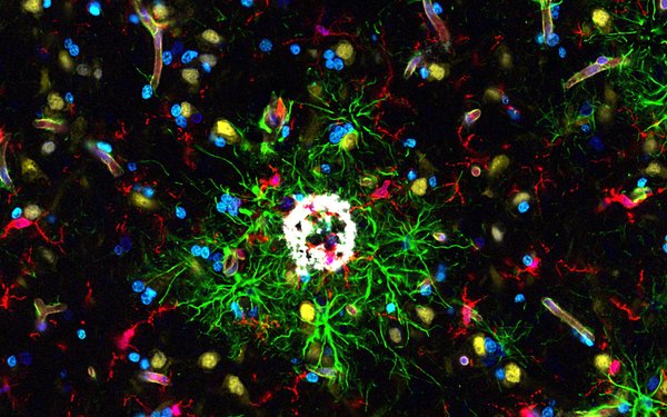 Wieghofer Neuroscience
