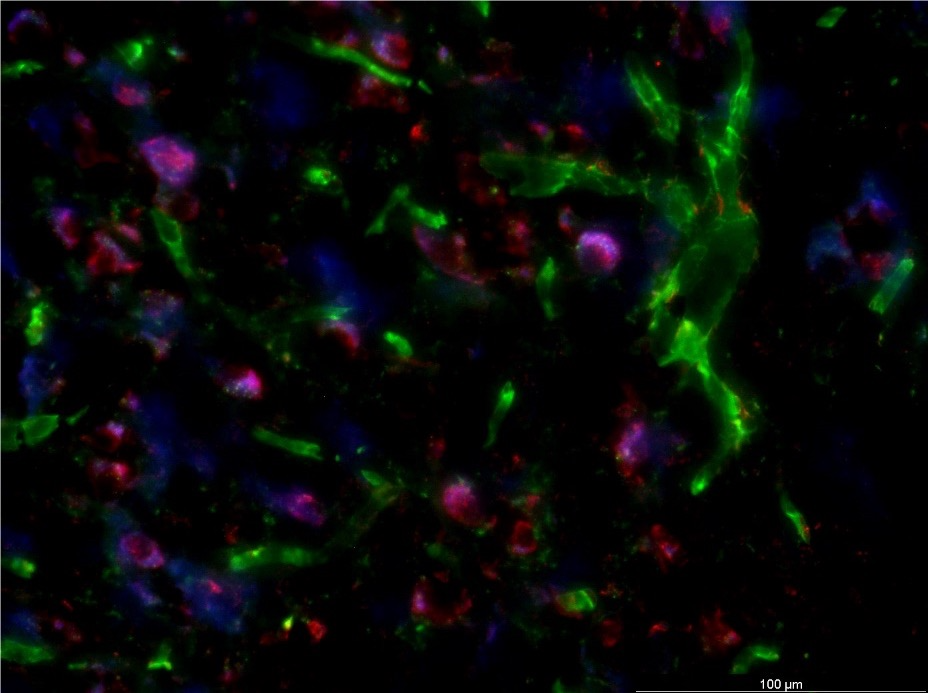 Elucidating mechanistic pathways of ambient particulate matter pollution on the cerebral vasculature