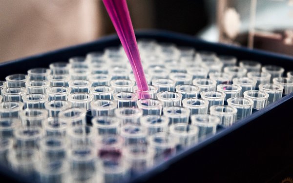 Pipette und Reagenzgläser