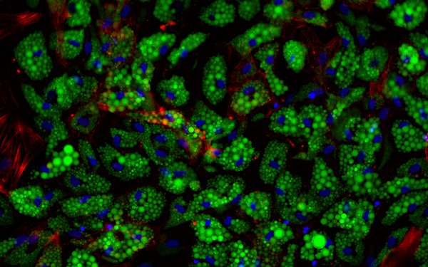 Adipocytes
