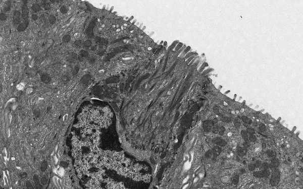 Elektronenmikroskopische Aufnahme einer Tuft Cell (Bürstenzelle) in der Gallenblase einer Maus