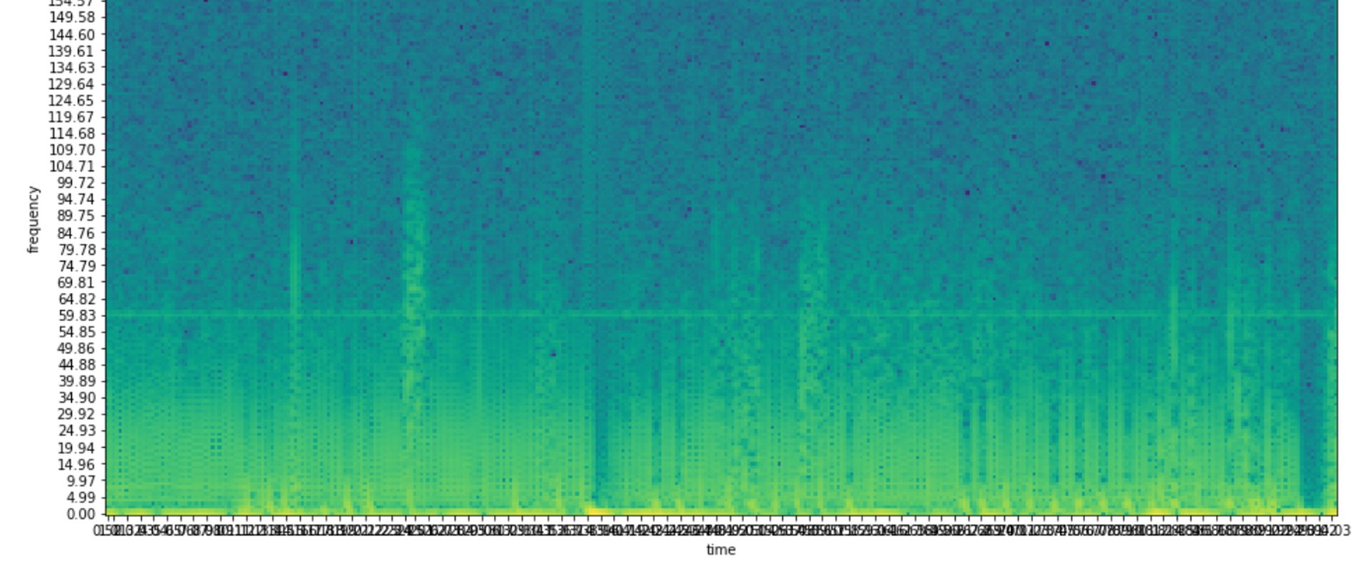 ECG Spectrogram