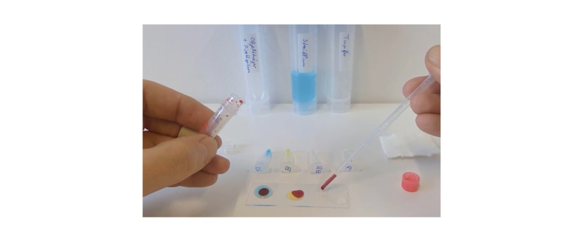 Praktikum Blut